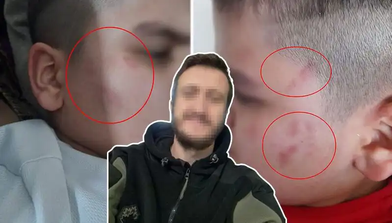 Otizmli Çocuğa Okulda Dayak İddiası: Aile Şikayetçi Oldu