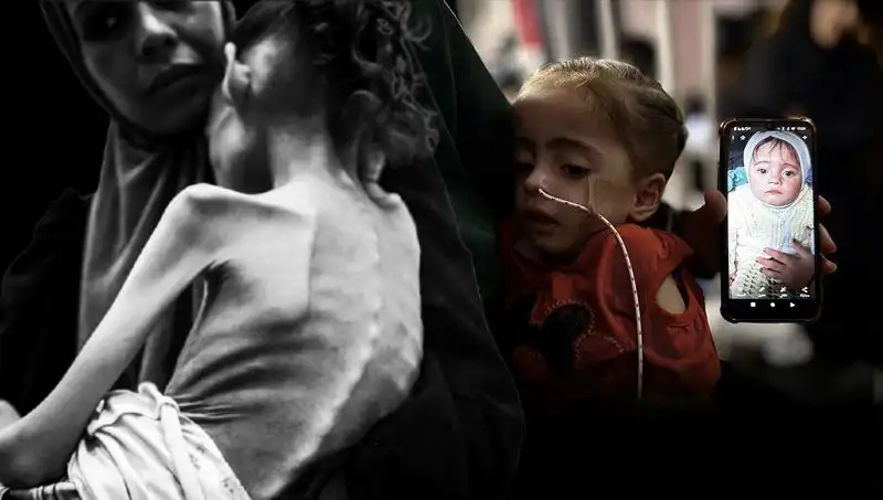 Küçük Meryem'in Açlık Mücadelesi: 25 Kilodan 10 Kiloya Düştü