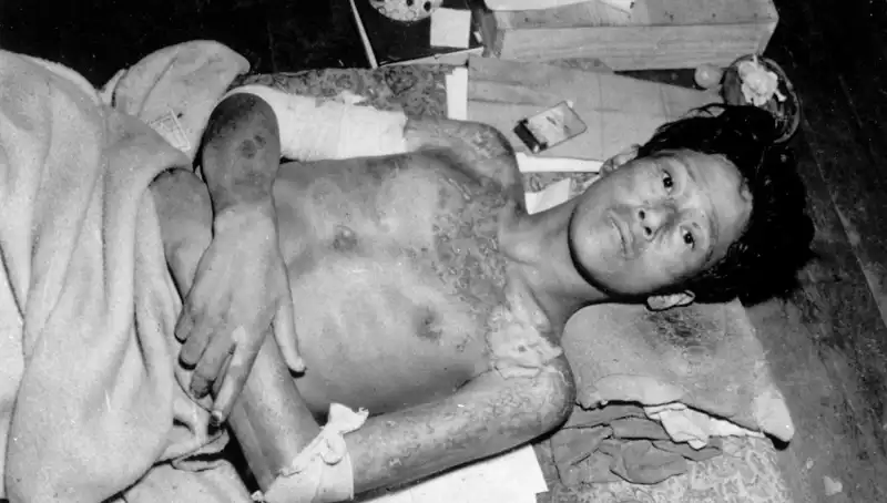 Nagasaki’den Gelen Uyanış: Nükleer Felaket Tehdidi Yeniden Gündemde