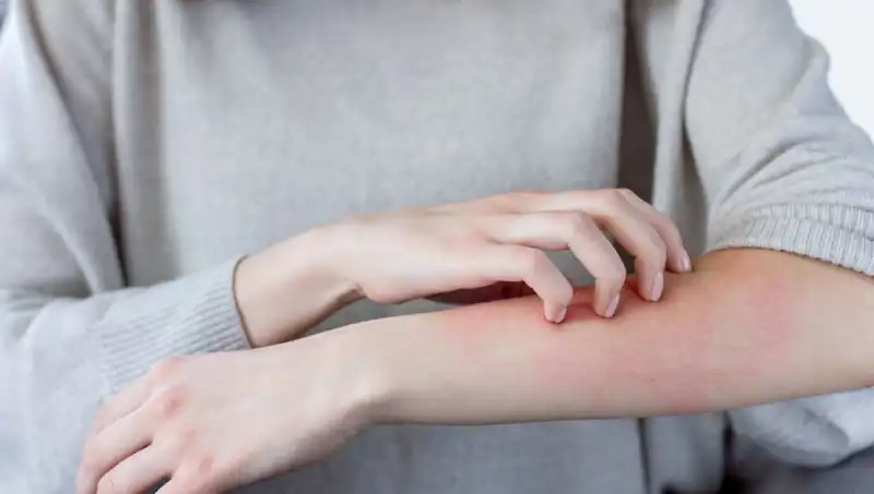 Dermatologlar Uyardı: Cilt Kanserinin İki Gözden Kaçan Belirtisi