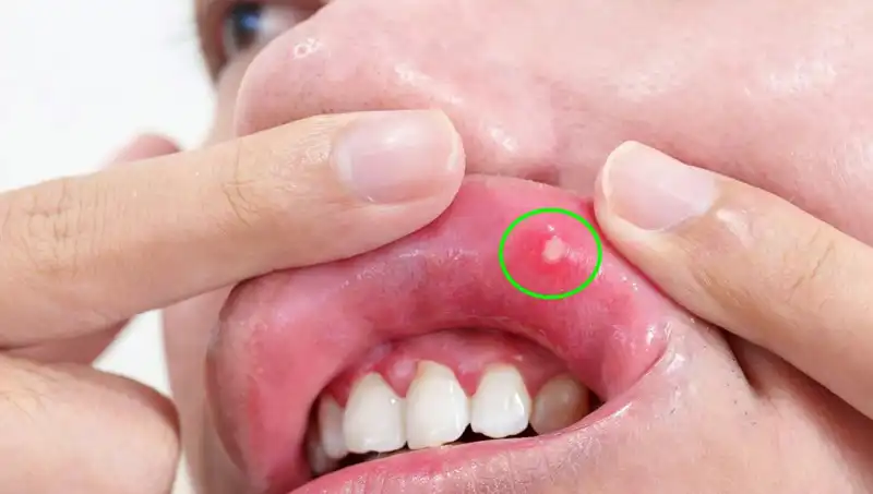 Kanserin Uyarı İşareti: Sağlık Sorunlarına Dikkat Etmemenin Sonuçları