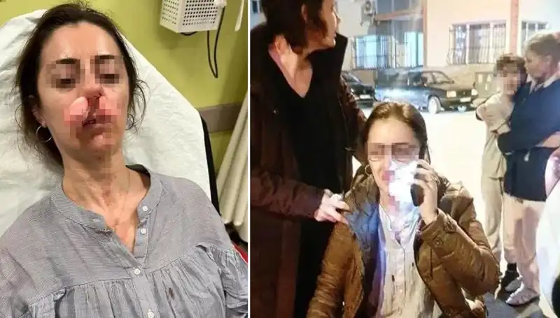 Eşinin Sevgilisini Sözde "Otomobil Kapısı"yla Vurdu: Sosyal Medya Şaşkın!