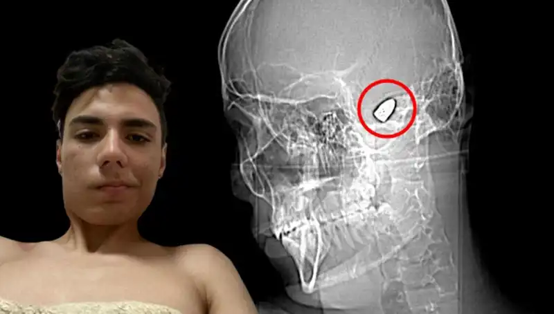 Kafasında Patlayıcı Var: Psikolojik Sorunların Tehlikeli Yanı