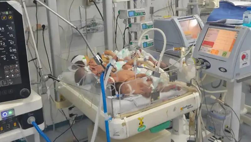 Gazze'deki Doktorlar Çaresiz Kalıyor: Yetersiz Kaynaklarla Mücadele Ediyorlar